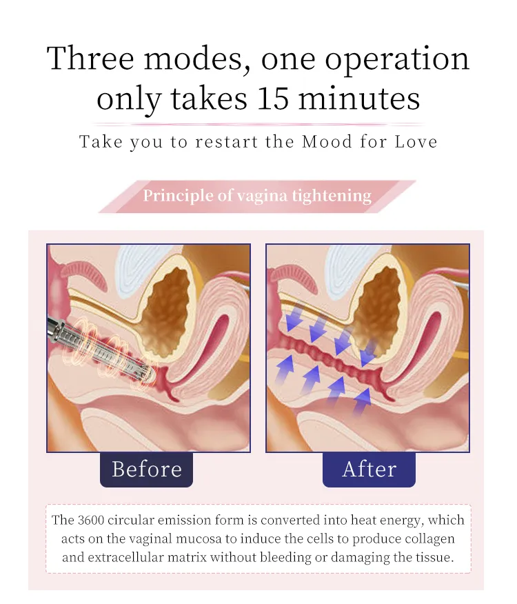 Fractional CO2 Laser for Skin Tightening Skin Rejuvenation Scar Removal Skin Beauty Device