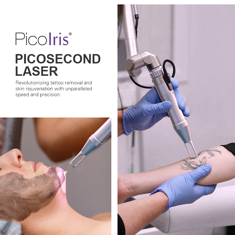 Portable Picosecond Q Switched Nd Yag Picosecond Carbon Laser Peel Pigment Tattoo Removal Machine