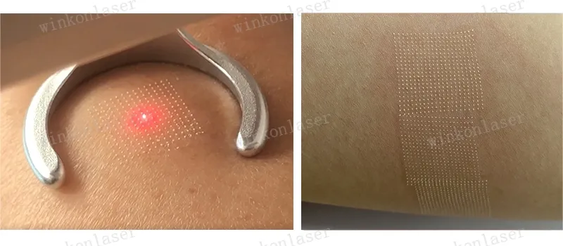 Treatment patterns