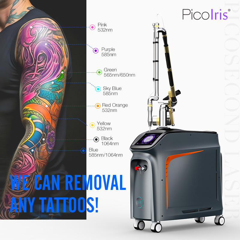 Portable Picosecond Q Switched Nd Yag Picosecond Carbon Laser Peel Pigment Tattoo Removal Machine