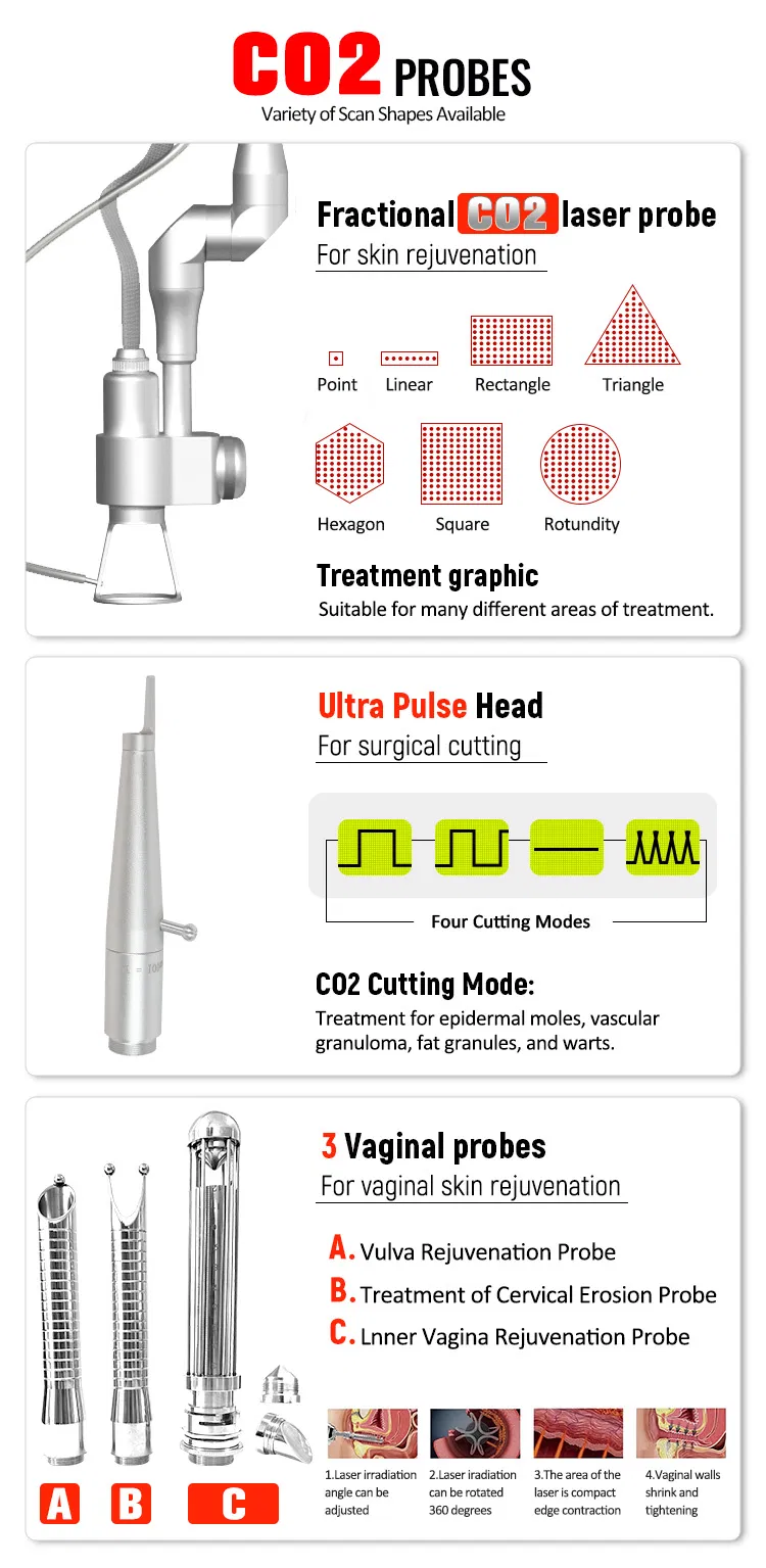 Laser Handle Mechanism