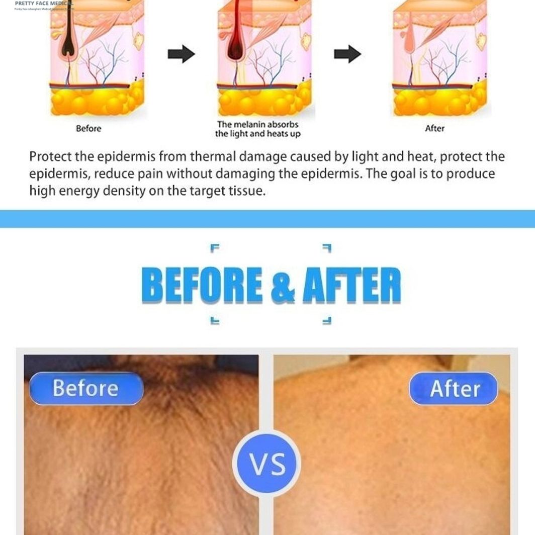 Z Cold Air Skin Cooling System Machine For YAG CO2 Fractional Picosecond Laser Treatments ABS Reduces Pain Protects Epidermis