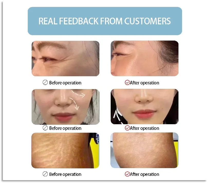 Before and After results