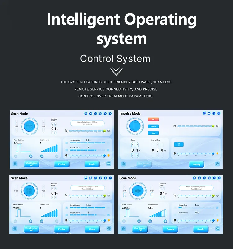 System Interface Advantages