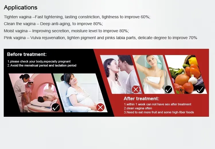 Theory of RF co2 fractional laser