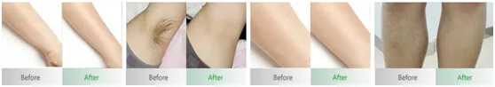 Before & After Treatment Results