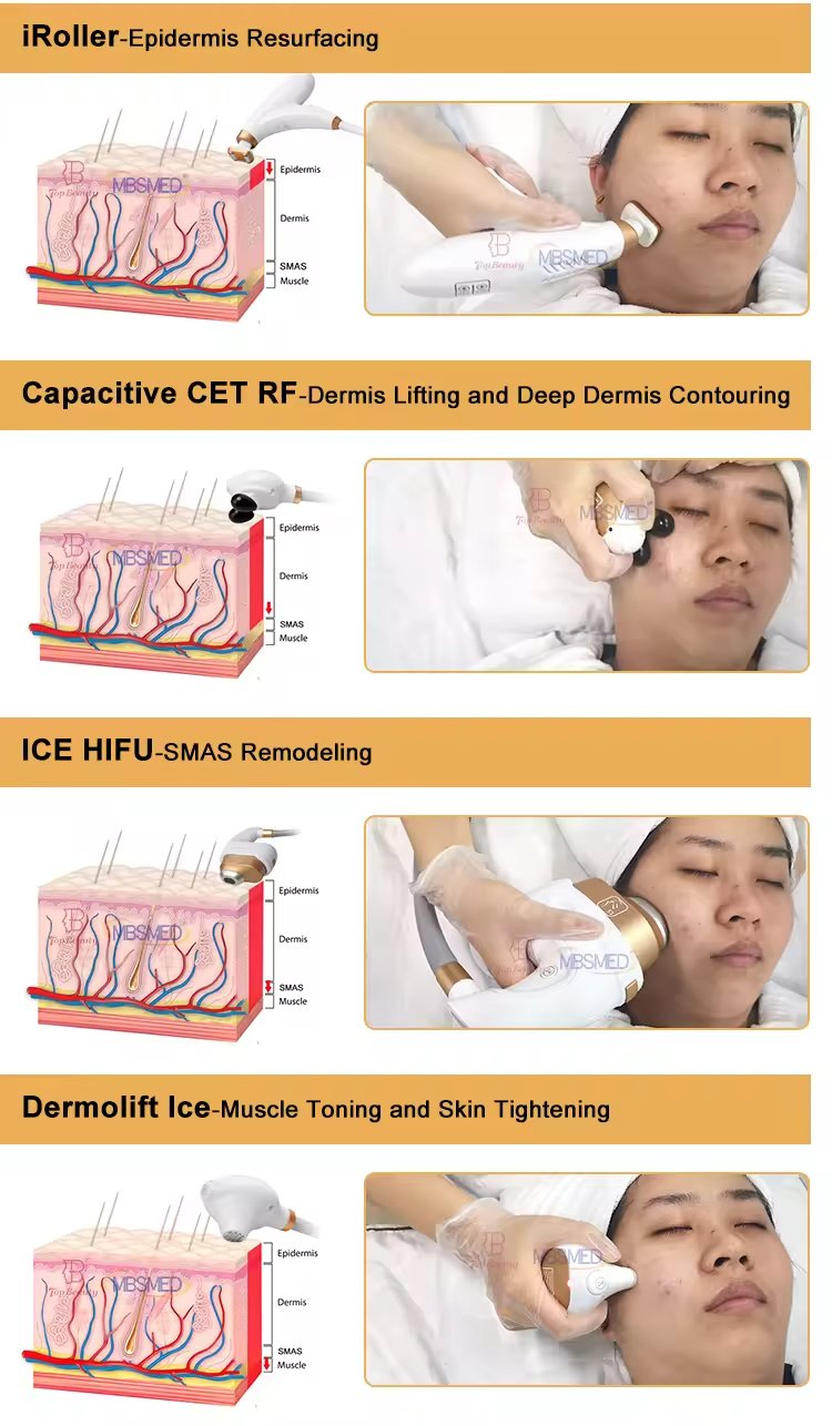 RF High Radio Frequency Skin Tightening Wrinkle Remover Face Lifting 7D 14D 20d 5D Ultrasonic Hifu Machine