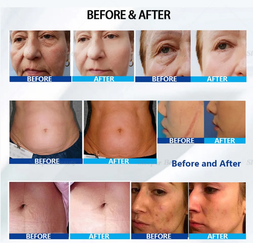 Before and After Treatment Results