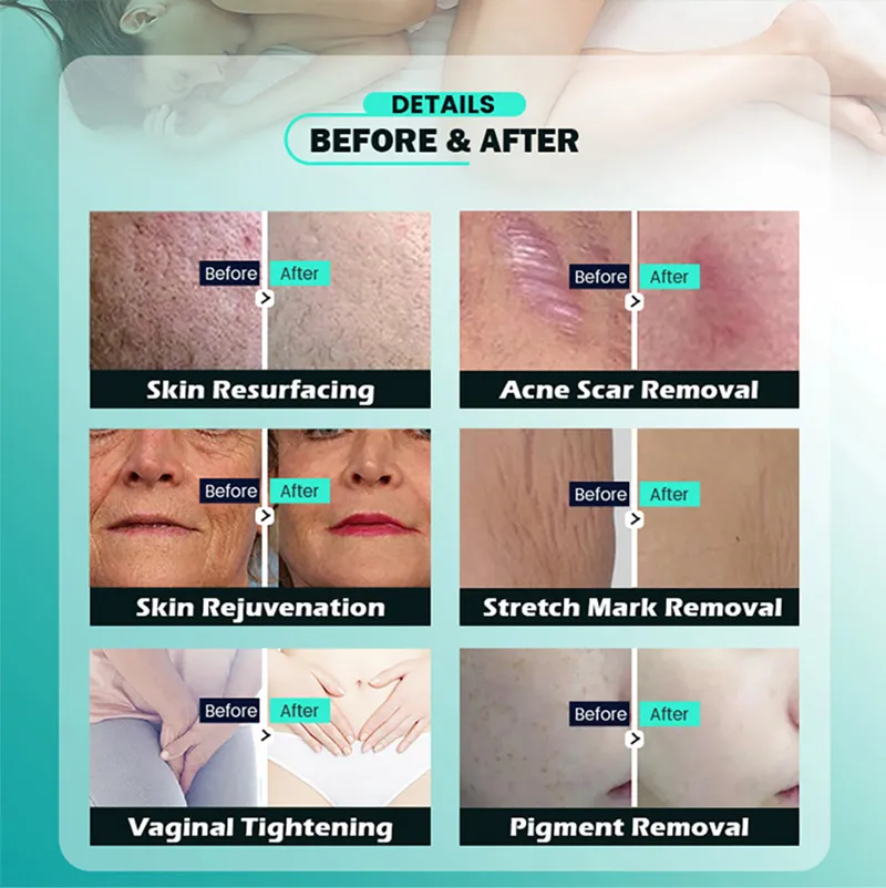 Before & After Results