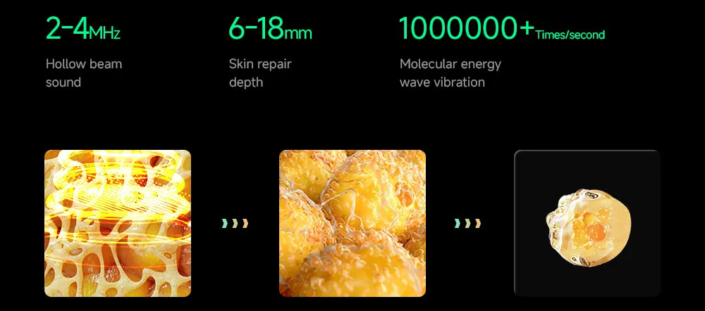 Shock wave fat reduction mechanism