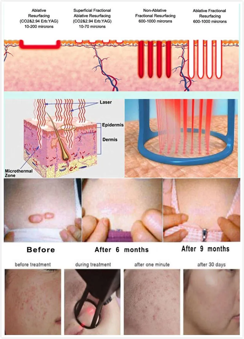 Before and After Treatment Effect 2