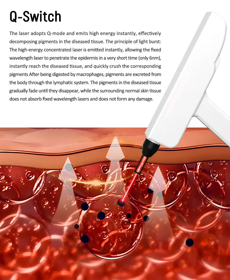 Resurfacing Fractional Laser