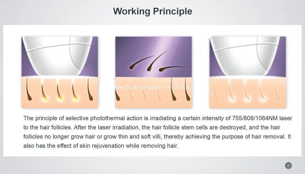 Diode Laser Hair Removal Theory