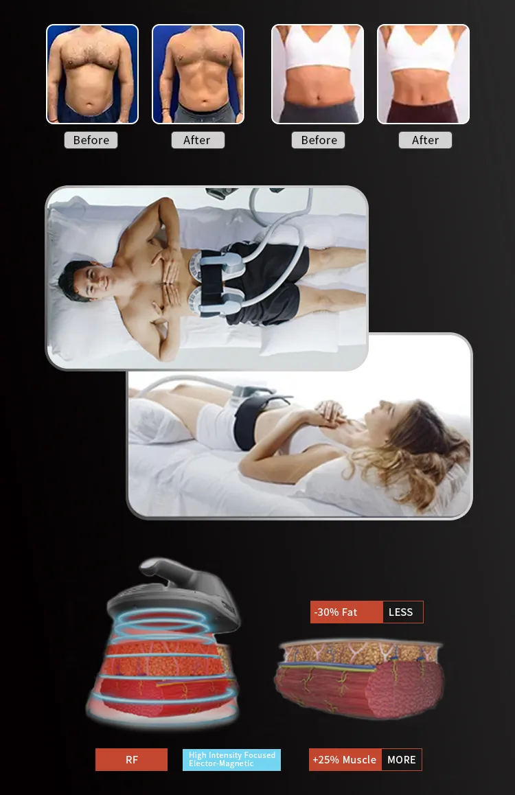 EMS Body Sculpting Machine Application