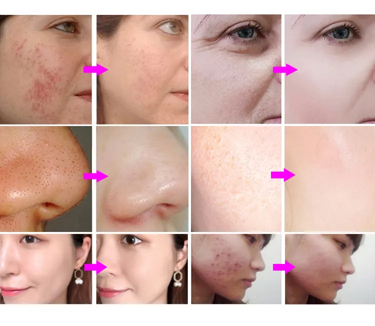 Before & After results comparison