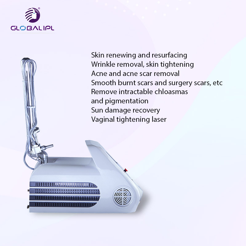 Fractional CO2 Laser Vaginal Rejuvenation