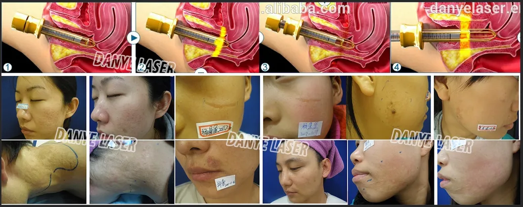 Before and After treatment results