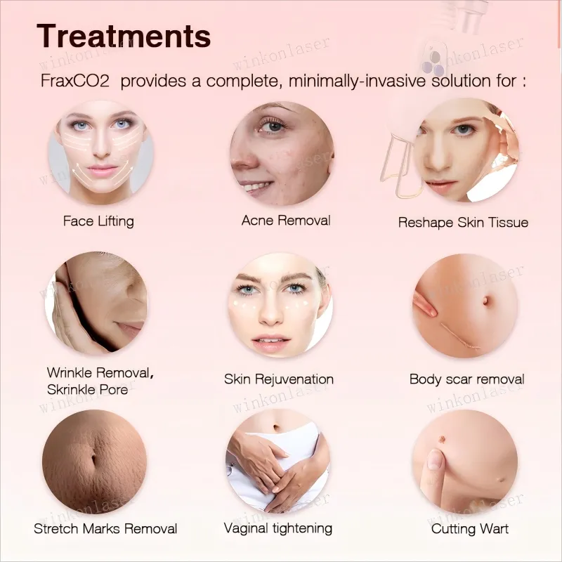 Fotona 4D CO2 Fractional Laser Vaginal Rejuvenation Fractional Laser Skin Resurfacing Machine
