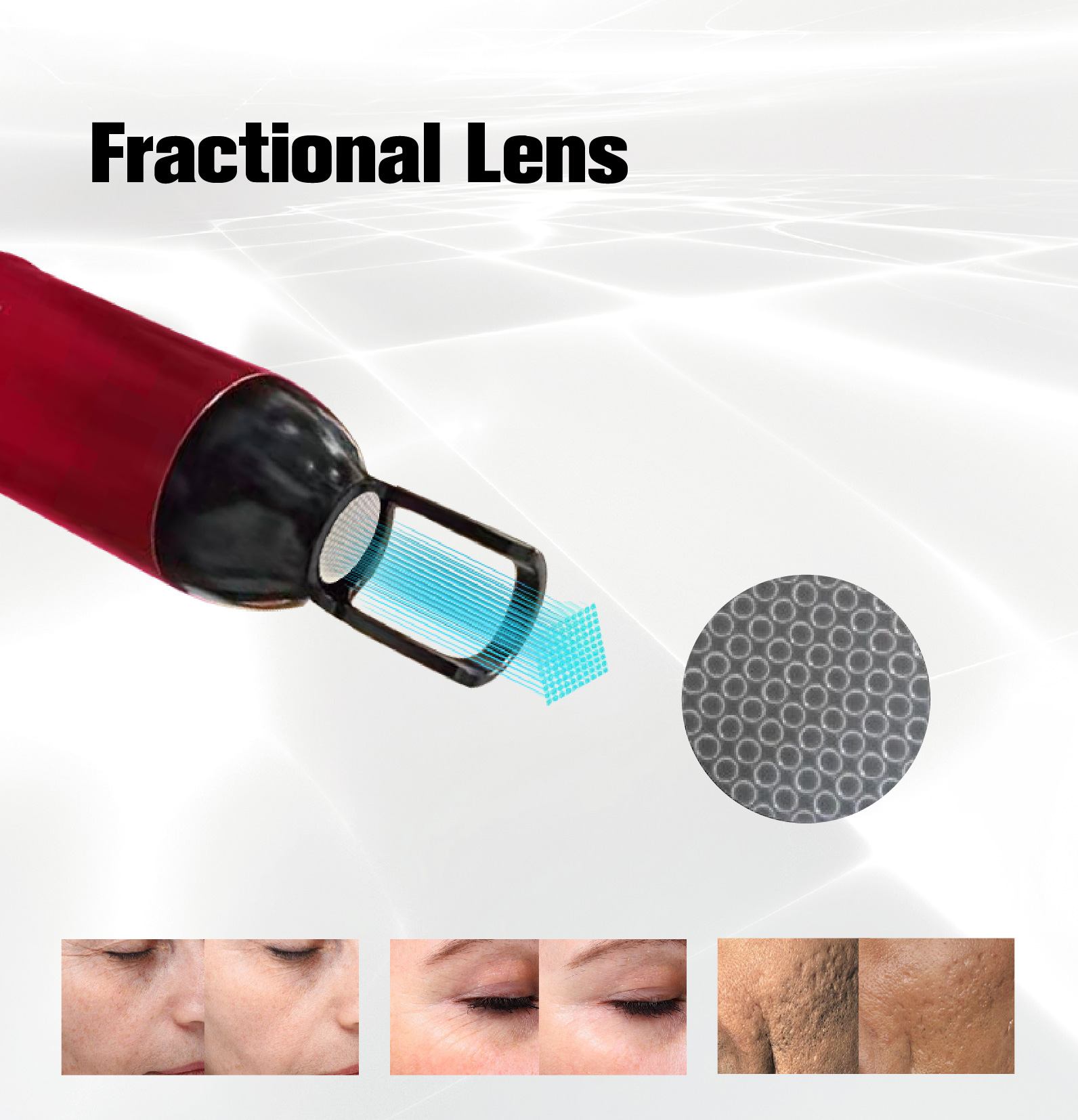 Fractional Lens