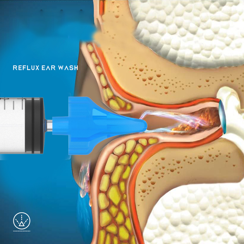 Tipo de Seringa 10ml Design Alargado Lavador de Ouvido Refluxo Limpeza de Ouvido Irrigação para Bebês Segurança