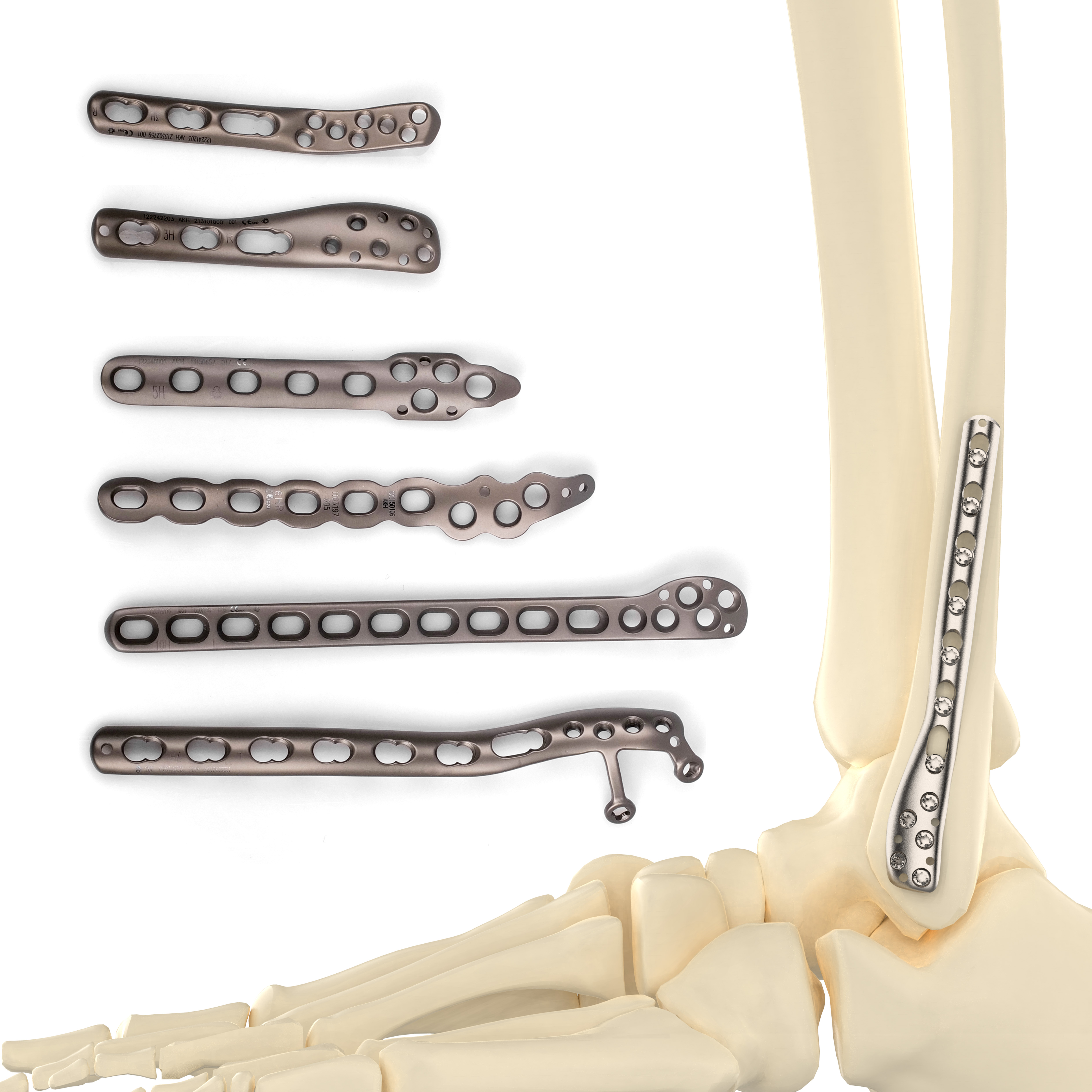 CANWELL Fibula Plate VA Distal Lateral Anatomic Titanium Locking Plate Bone Orthopedic Implants Factory Trauma Surgery CE ISO