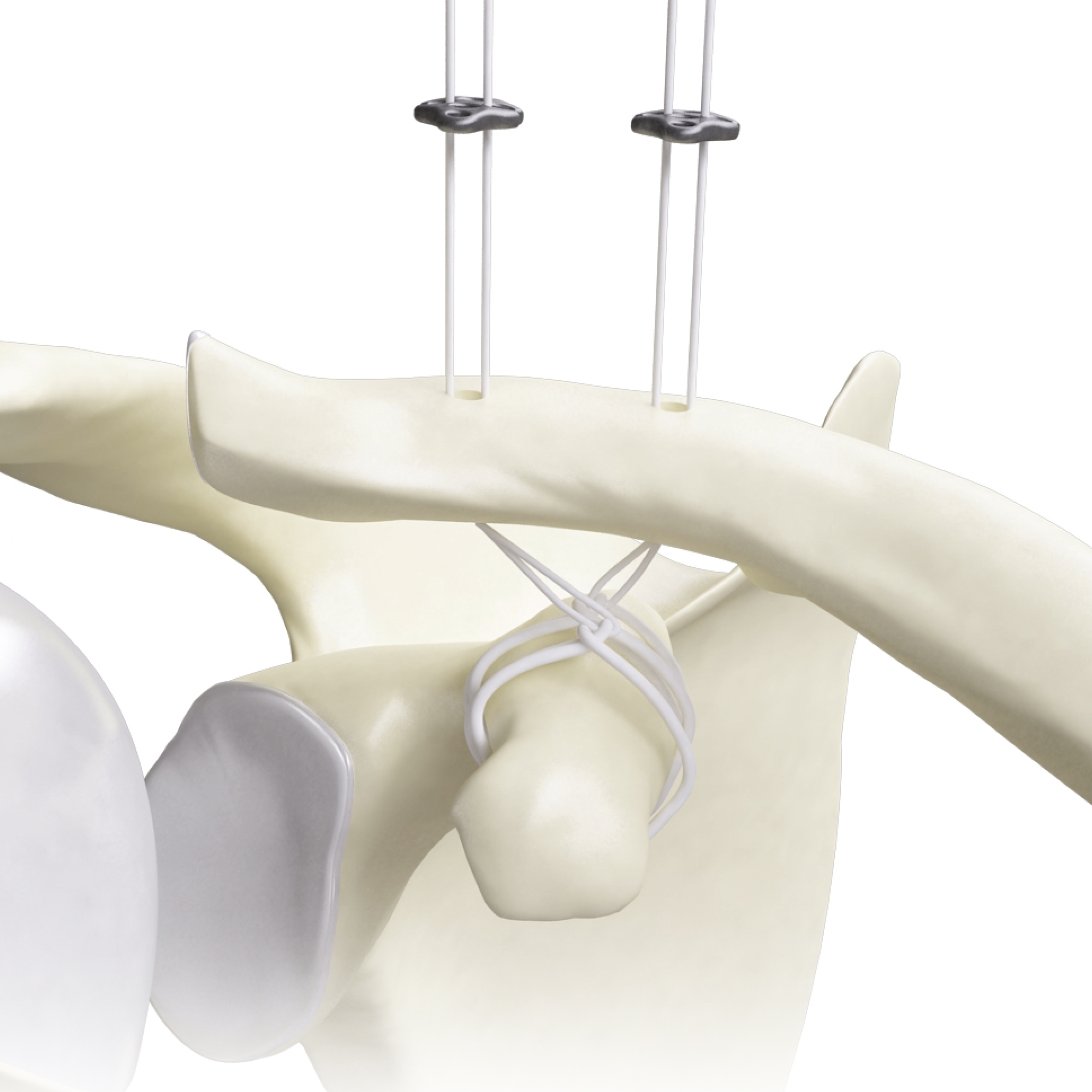 CANWELL Arthroscopy Button Acromio Clavicular Joint Button AC Repair Button Orthopedic Sports Medicine
