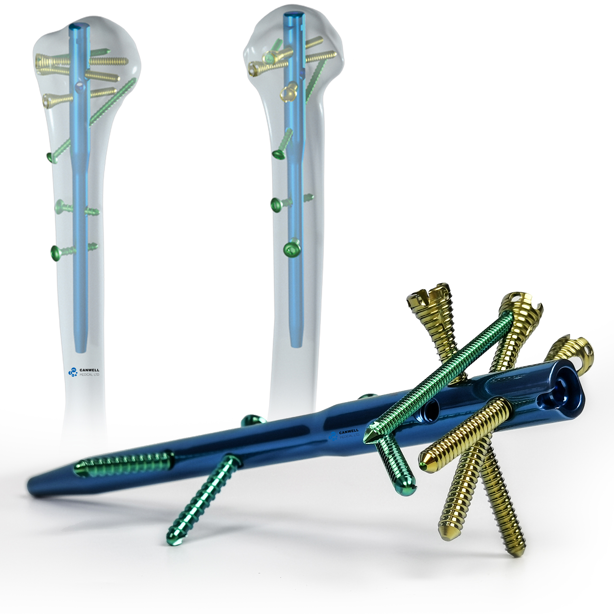 CANWELL Multi-lock Humeral Intramedullary Nail Orthopedic Implant CE ISO Certified Titanium IM Nails Instrument Set