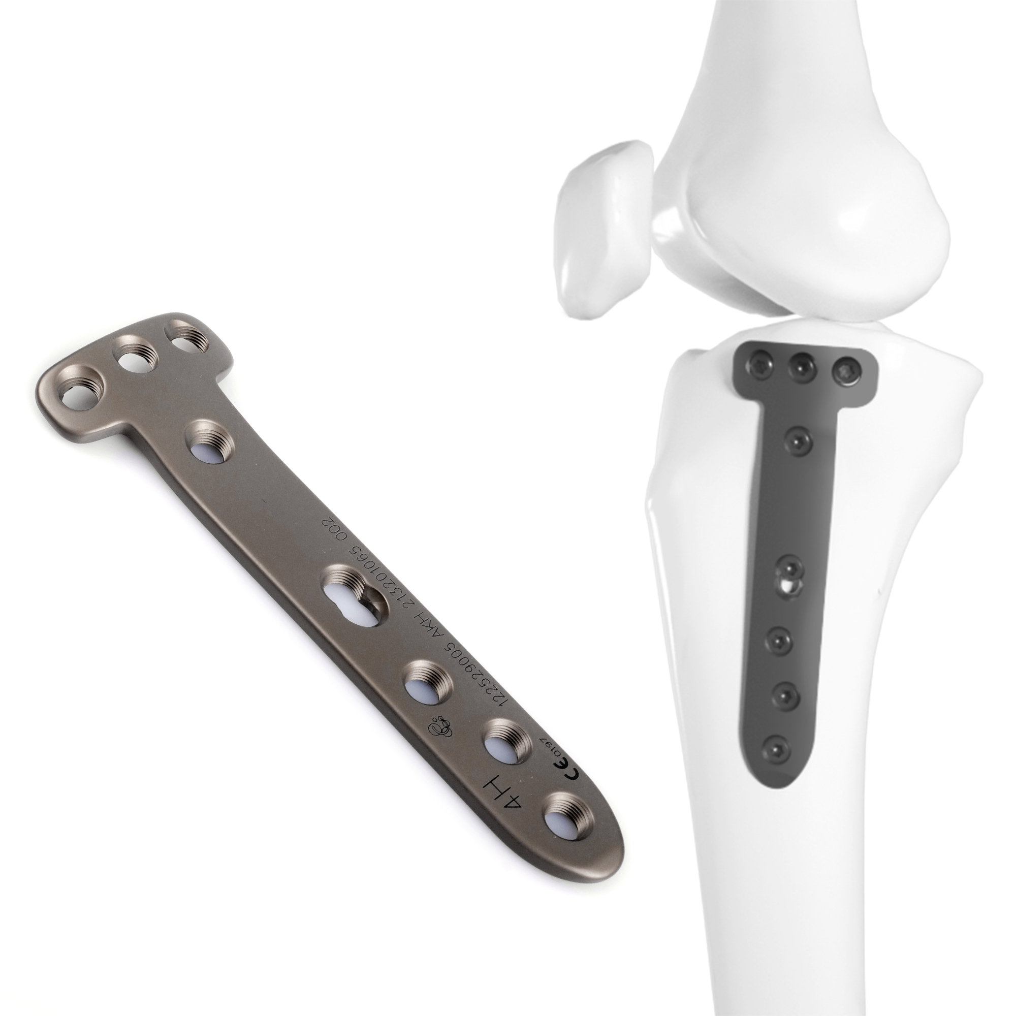 CANWELL Titanium Proximal Tibia Locking Plates Narrow Bone Locking Compression Plate Implant for Orthopedic Fracture Osteotomy