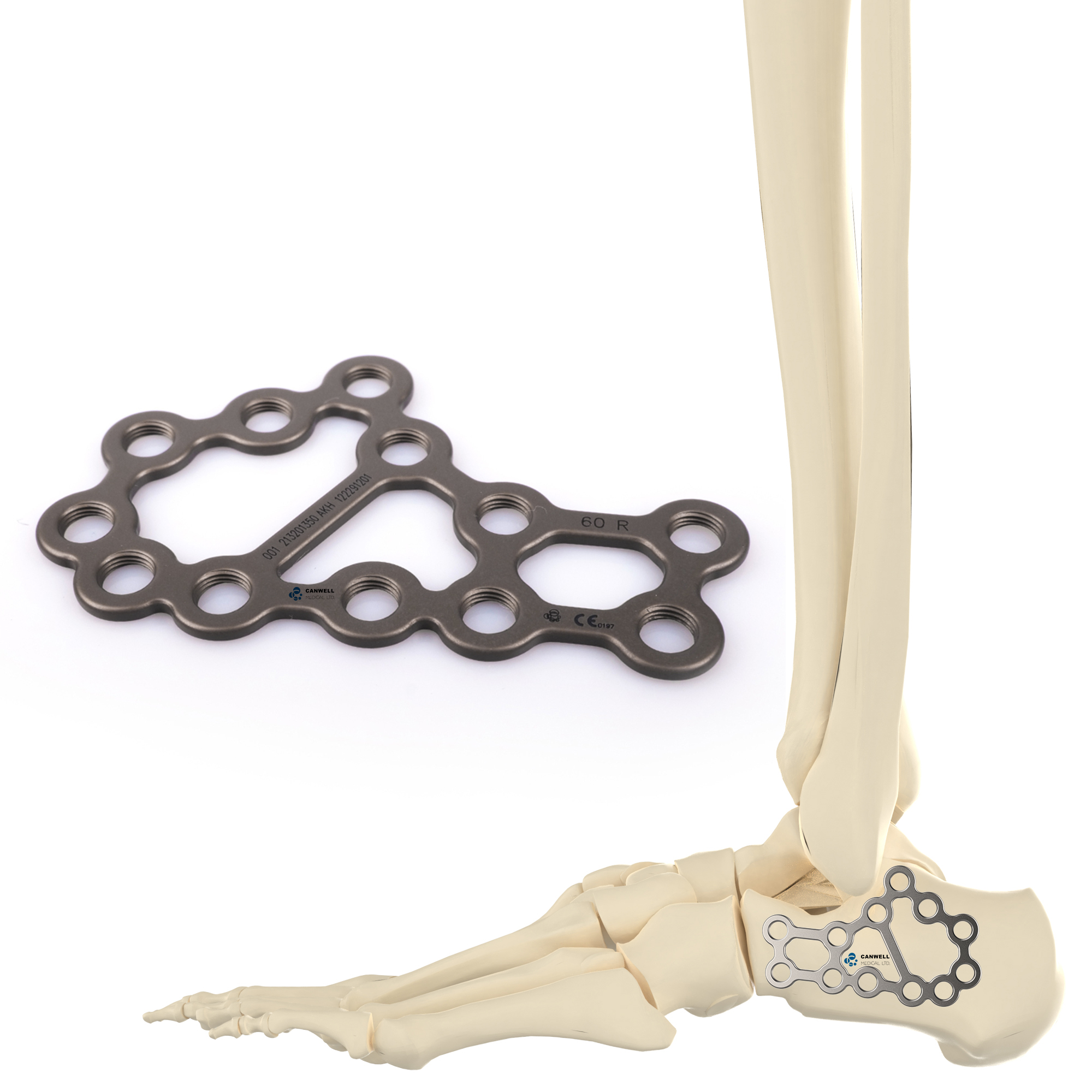CANWELL Medical Calcaneal Locking Plate Titanium Foot Heel Bone Orthopedic Implants Factory Trauma Fracture Surgery OEM CE ISO