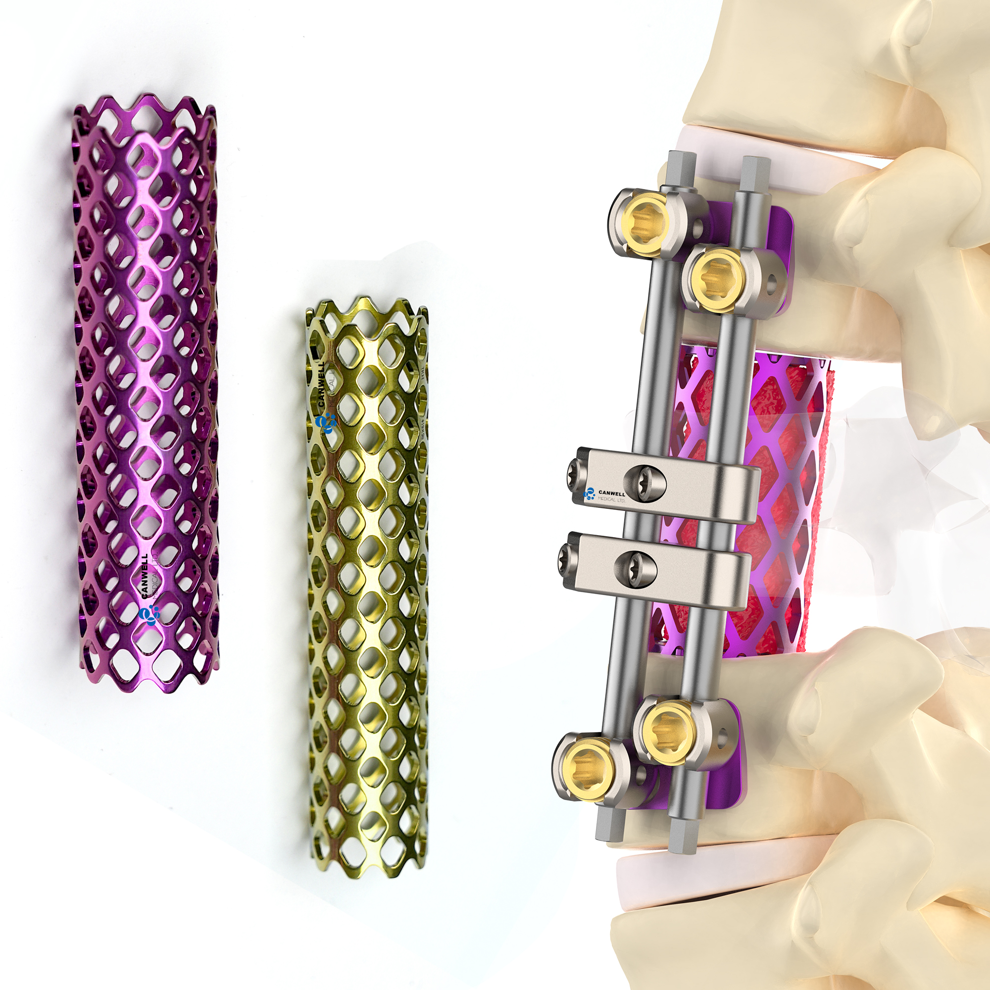 CANWELL Titanium Spine Mesh Cages Anterior Thoracolumbar Pedicle Screw Polyaxial Reduction Pedicle Spine Minimally Invasive