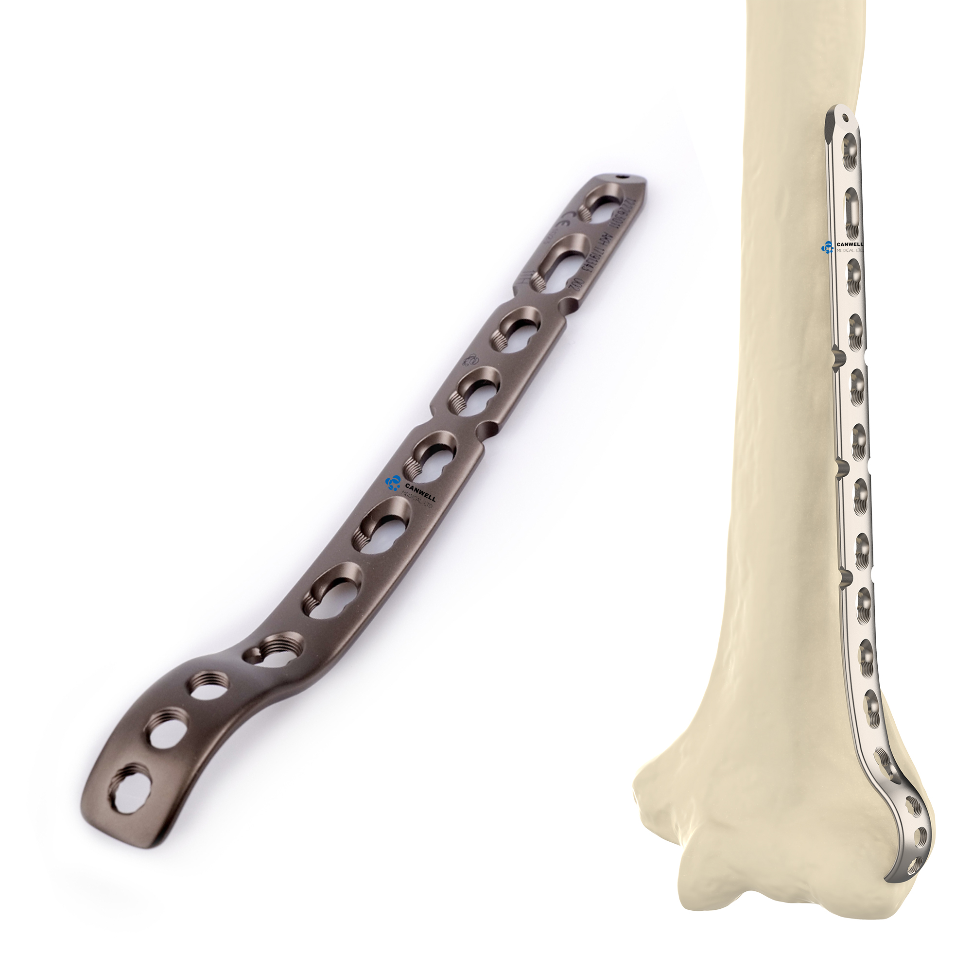 Canwell Distal Humeral Middle Metaphyseal Titanium Locking Plate Orthopedic Implants Trauma Fracture Surgery CE ISO