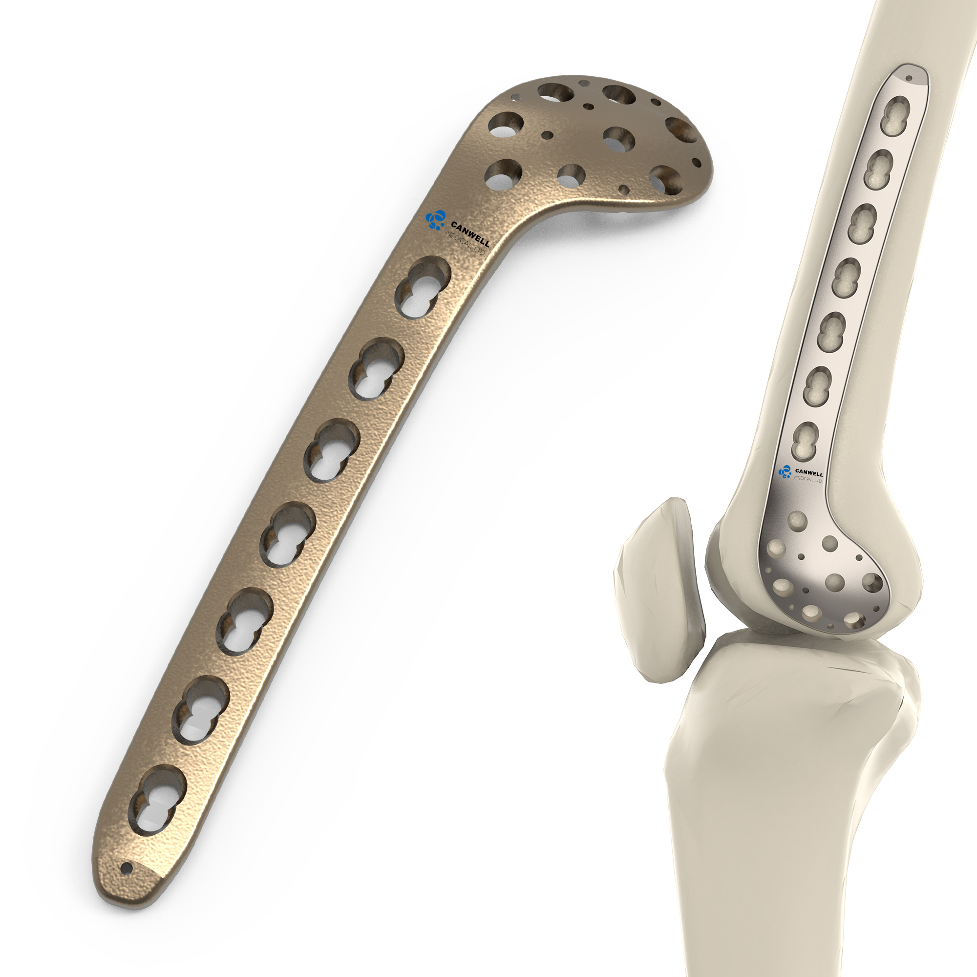 CANWELL Titanium Distal Medial Femoral Locking Plate Orthopedic Implant Factory Trauma Broken Bone Fracture Surgery CE OEM