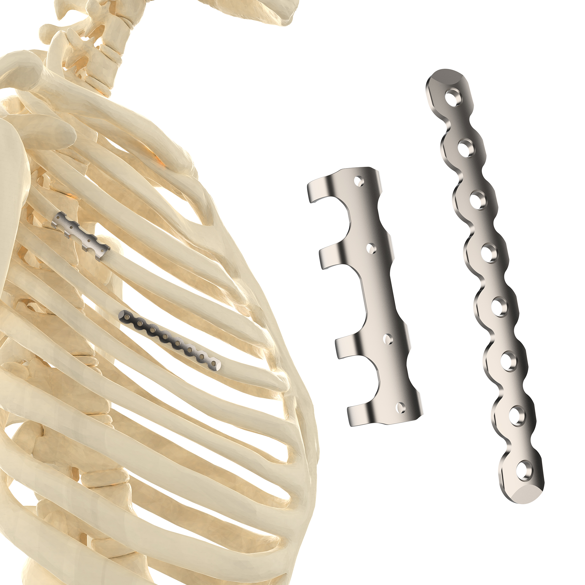 CANWELL Titanium Rib Locking Plate Bone Fixation Orthopedic Trauma Implant for Fracture Surgery CE ISO