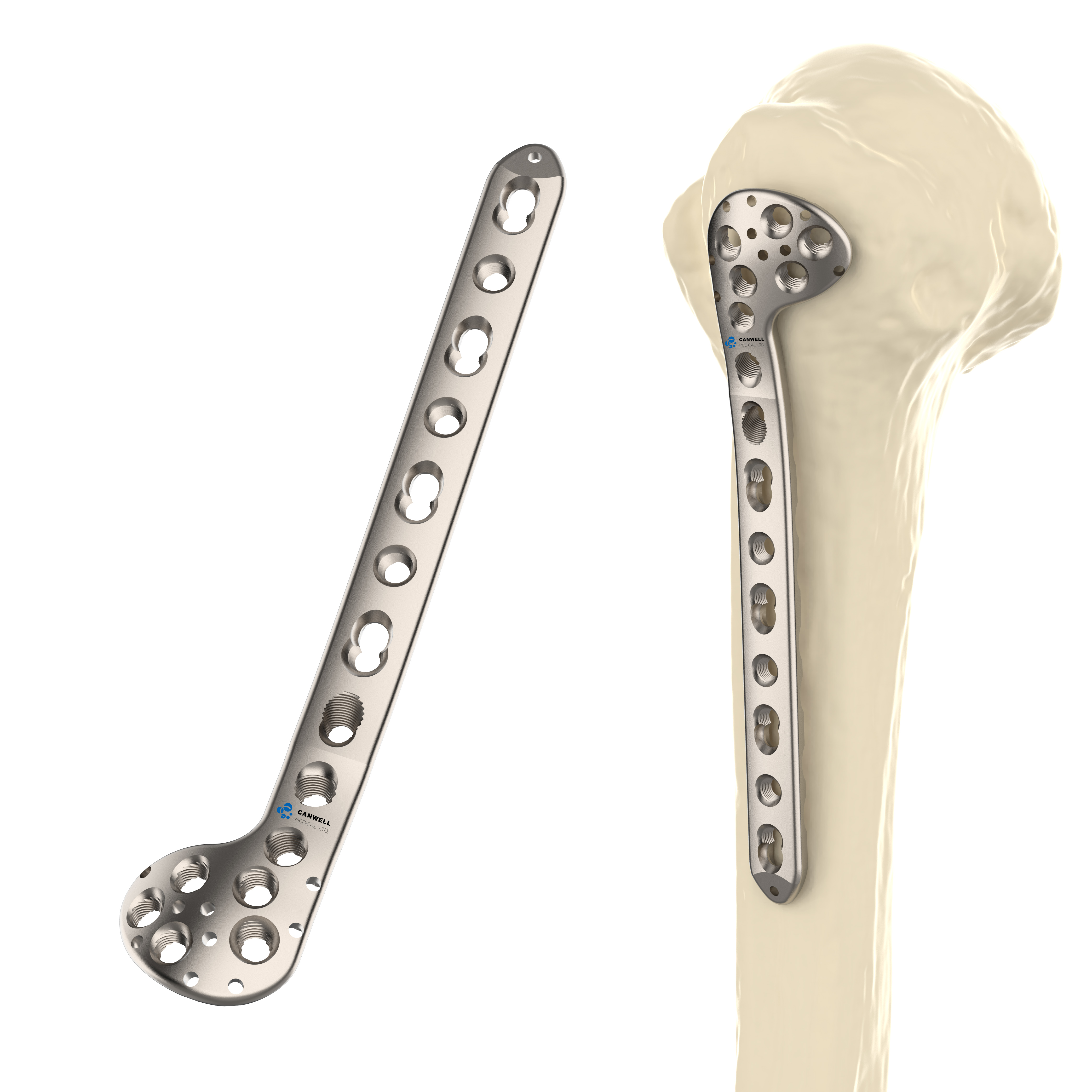 CANWELL Proximal Humerus Titanium Locking Plate Compression Orthopedic Manufacturer Trauma Factory OEM CE Certified