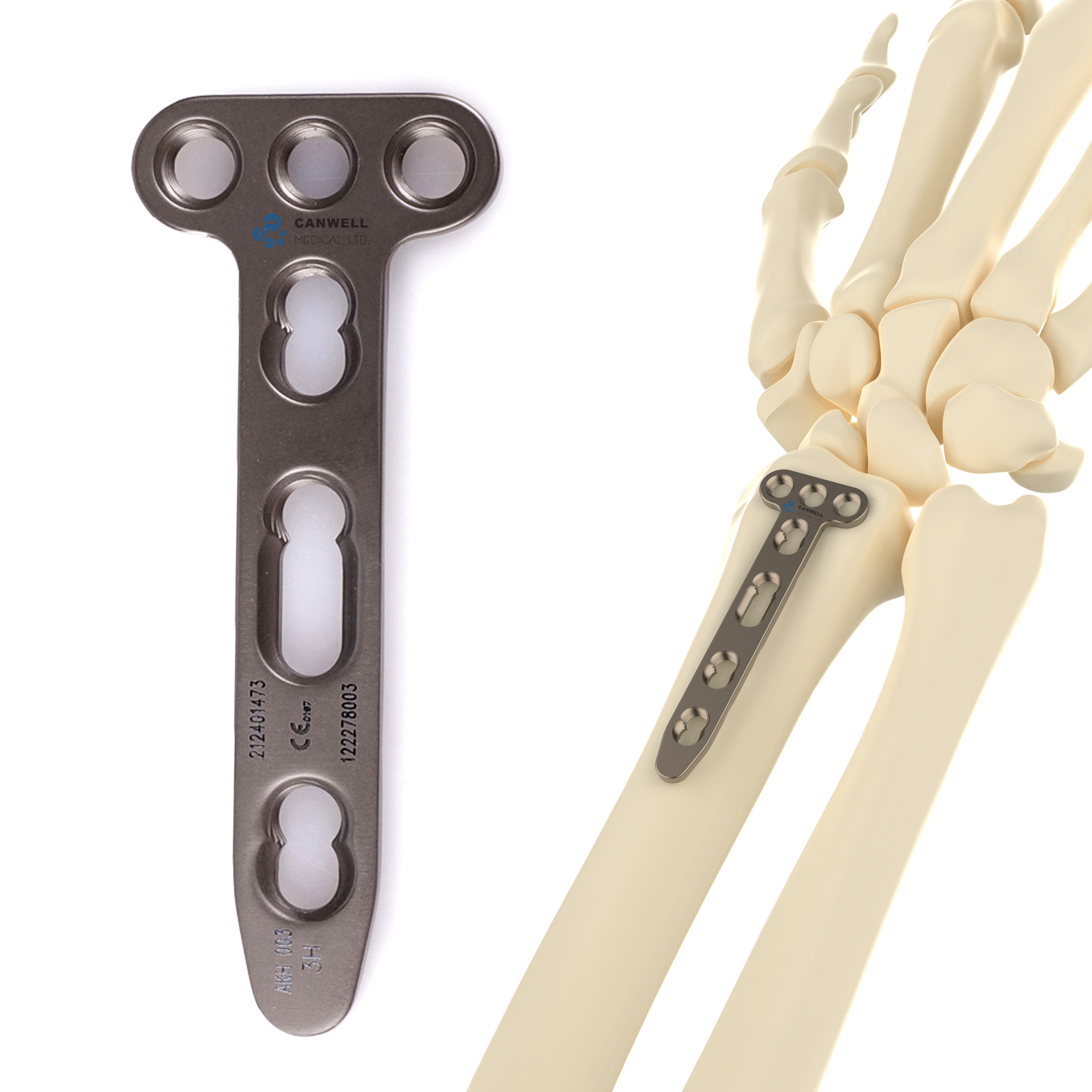 CANWELL Distal Radius TItanium Locking Plate Volar Wrist Orthopedic Trauma Implant Bone Fracture Suppliers Manufacturer CE ISO