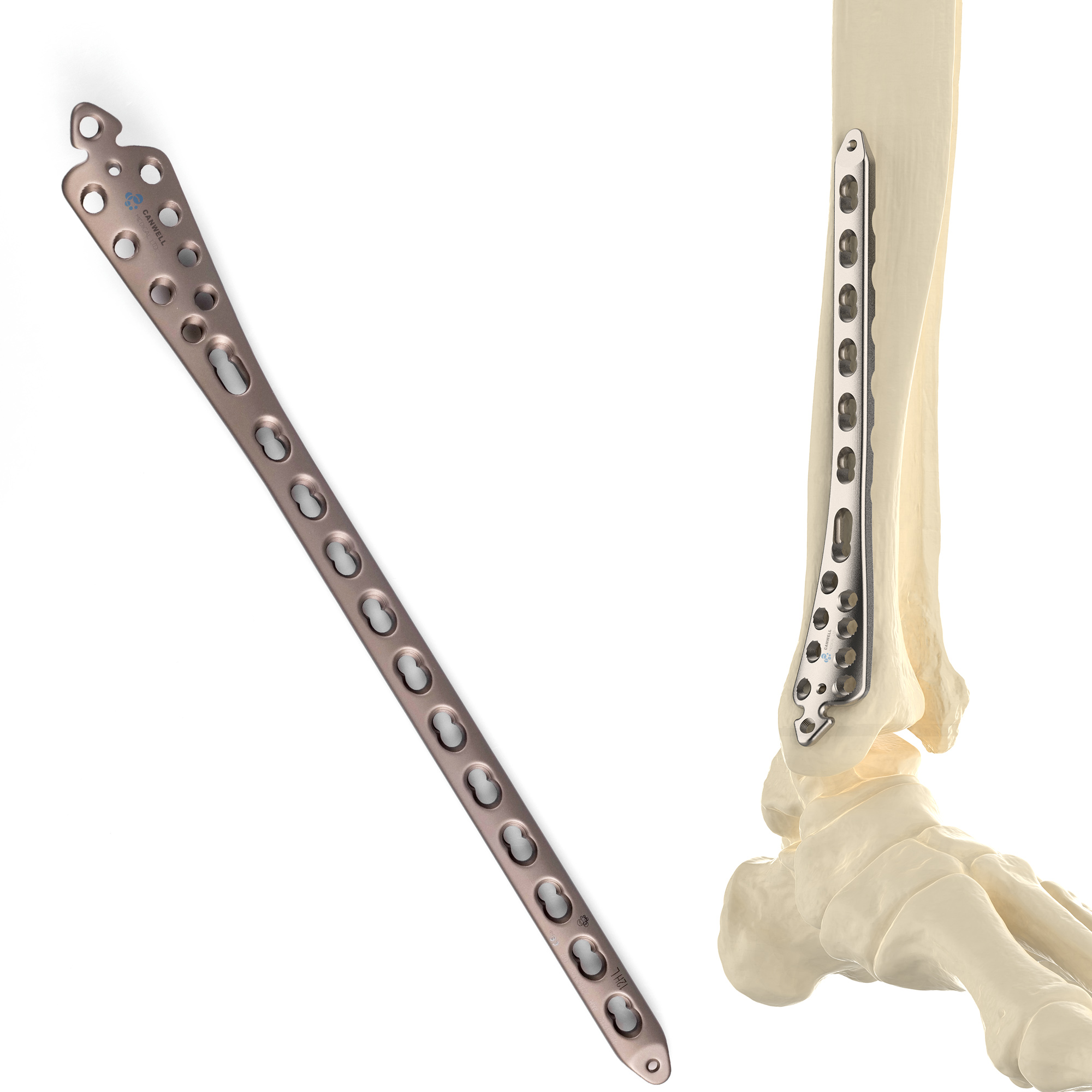 CANWELL Distal Medial Tibial Locking Plate 3.5mm Compression Bone Orthopedic Implants Trauma Fracture Surgery CE OEM Titanium