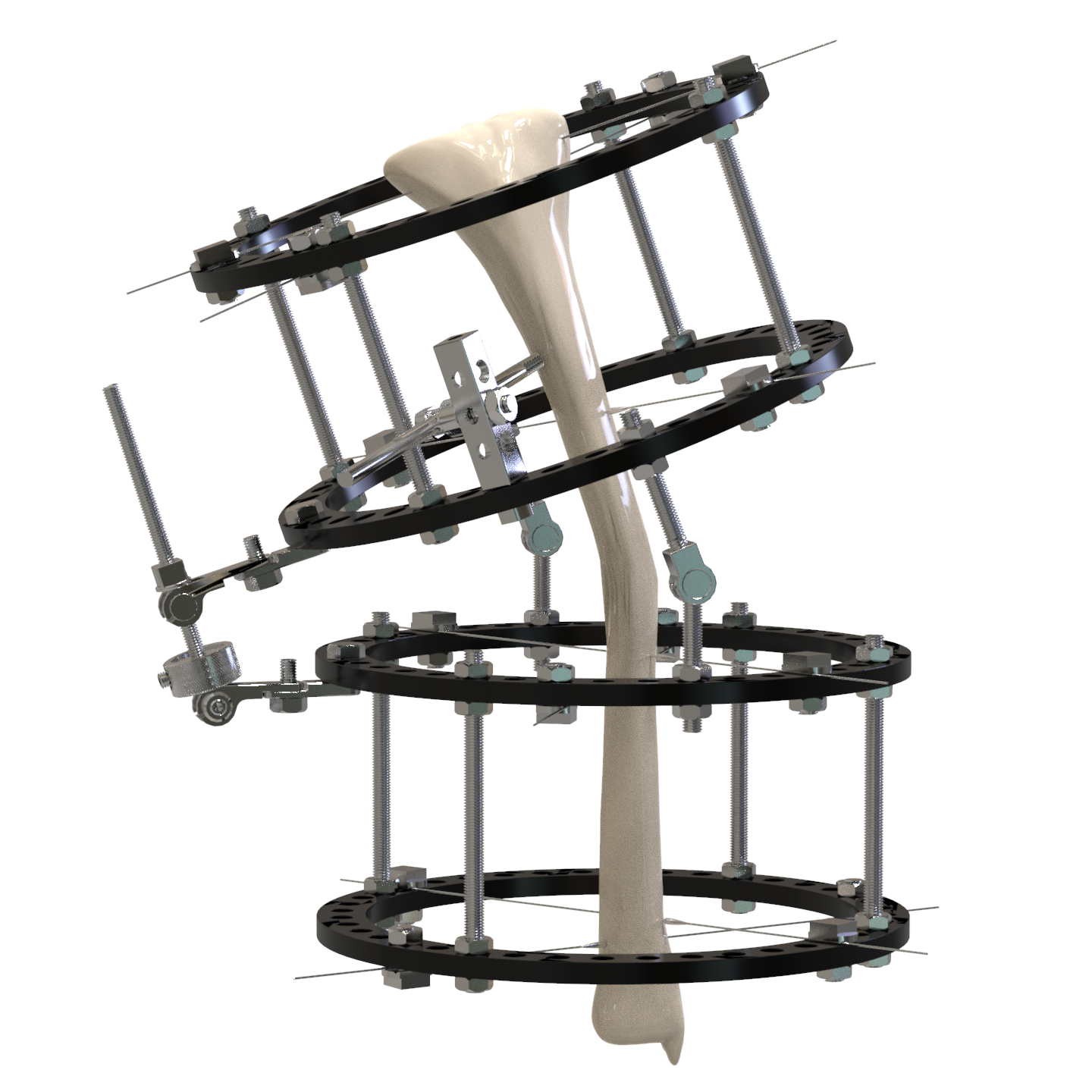 Medical Instrument Part 1