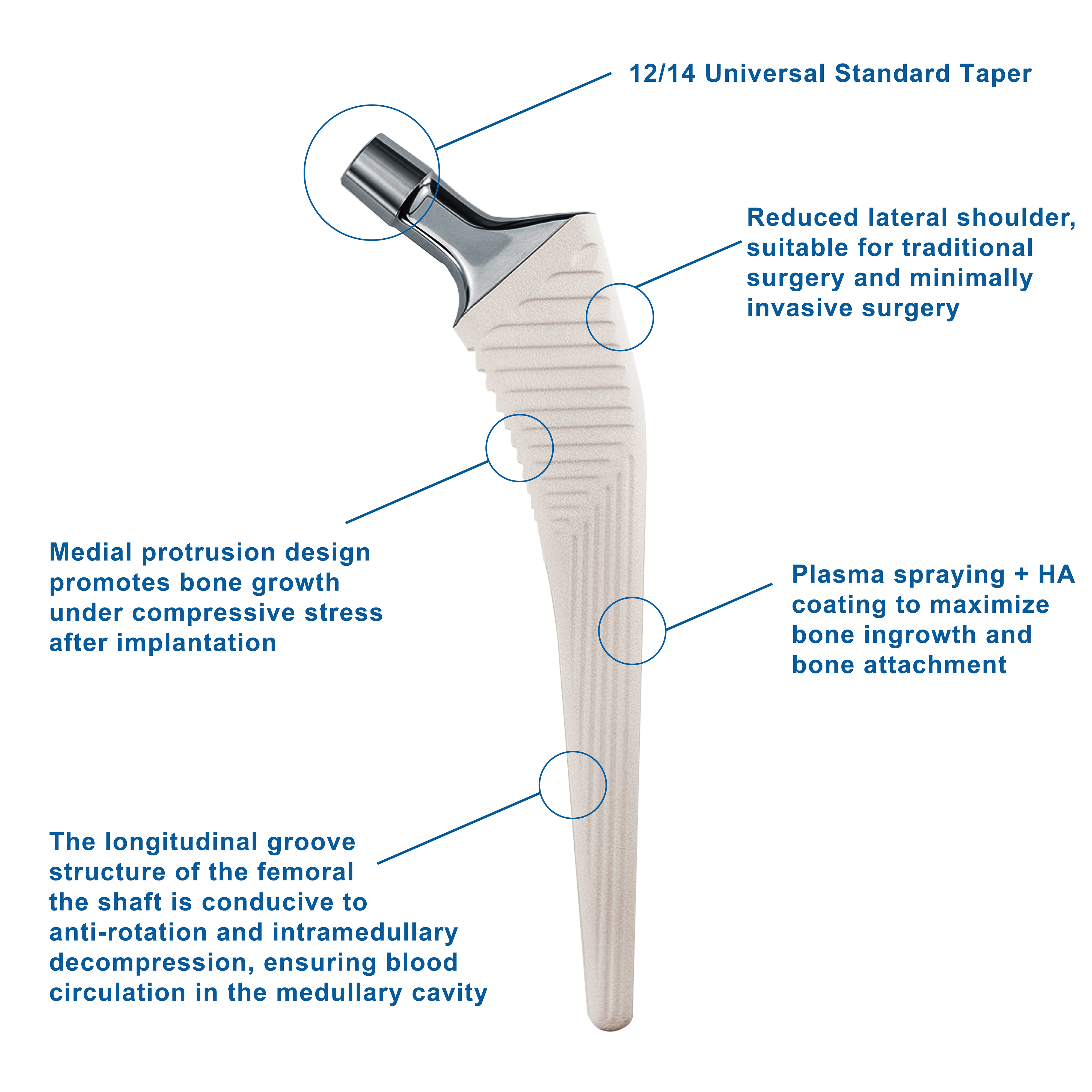 CANWELL Artificial Hip Titanium Hip Prosthetics Joint Replacement Non Cemented Total Hip Replacement CE