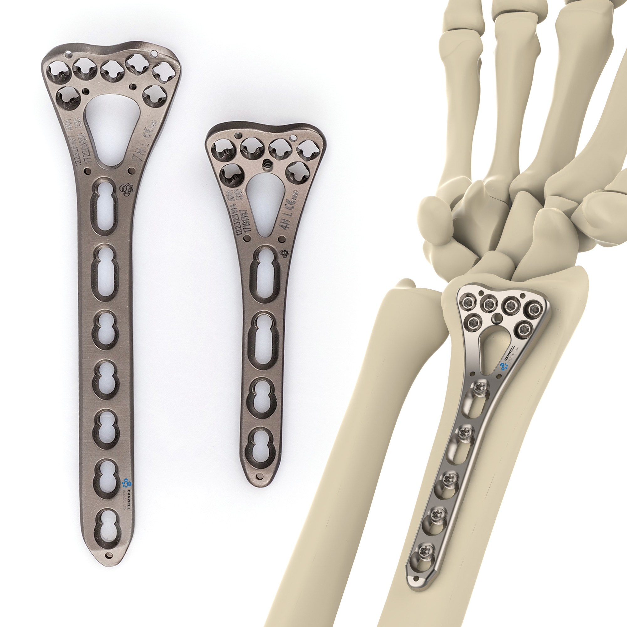 CANWELL Distal Radius TItanium Locking Plate Volar Wrist Orthopedic Trauma Implant Bone Fracture Suppliers Manufacturer CE ISO
