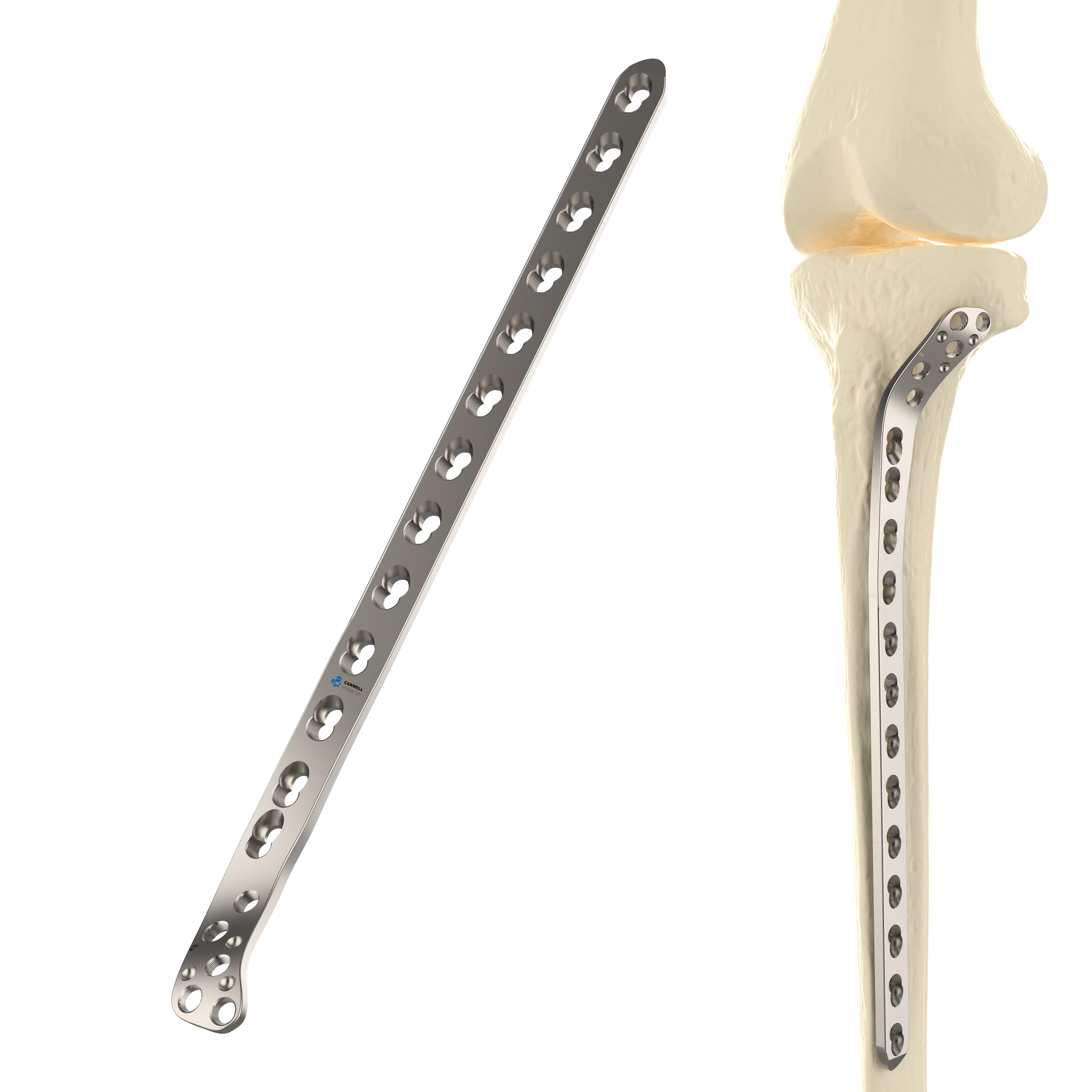 CANWELL Proximal Lateral Tibial Locking Plate  Orthopedic Trauma Implant Hospital Bone Plate 5.0mm Screw Orthopedic Manufacturer