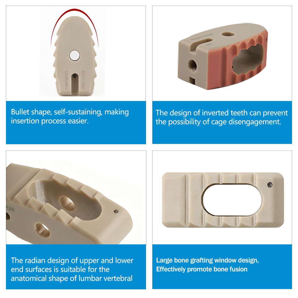 Medical-Grade PEEK Lumbar Interbody Fusion PLIF Cage