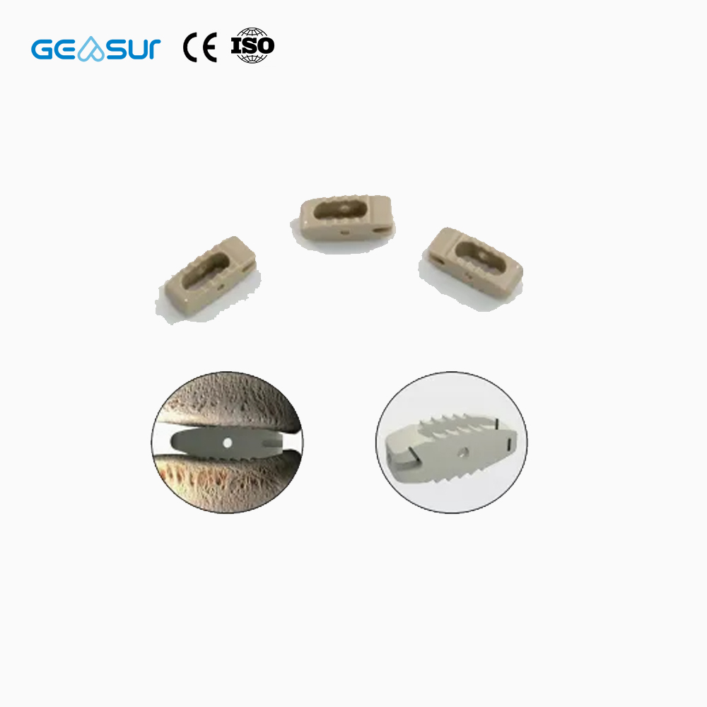 Geasure Titanium Coated Bullet Lumbar PEEK Fusion Cage-Premium Class III Spine Implant Surgical Instrument Kit 1-Year Warranty