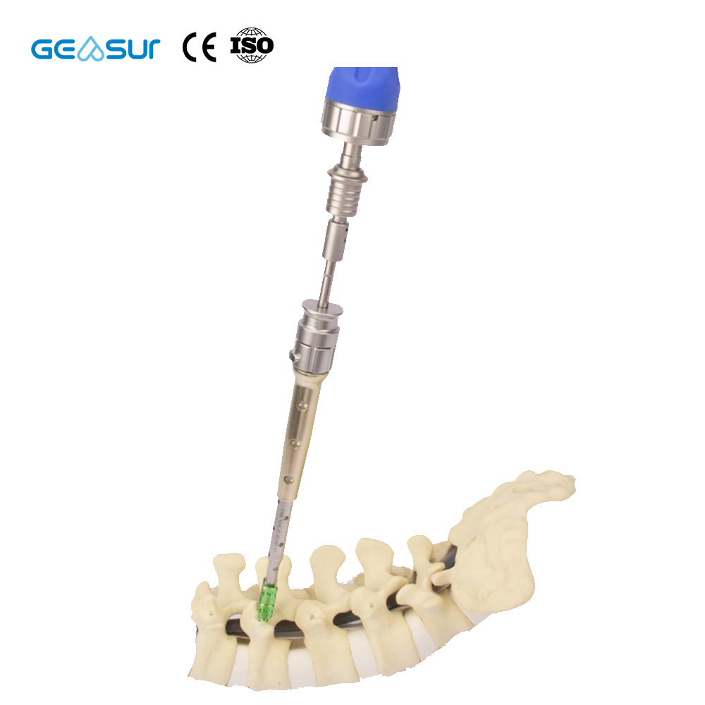 Geasure Back Trauma Spine Minimally Invasive Pedicle Screw for Hospital Use Class III Implantable Artificial Organ