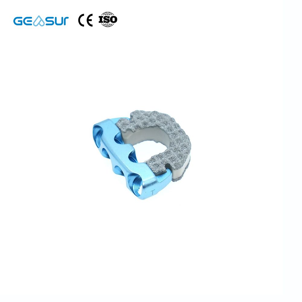 Geasure Zero-Profile Anterior Cervical Interbody Fusion PEEK Cage with Screw - Orthopedic Implant