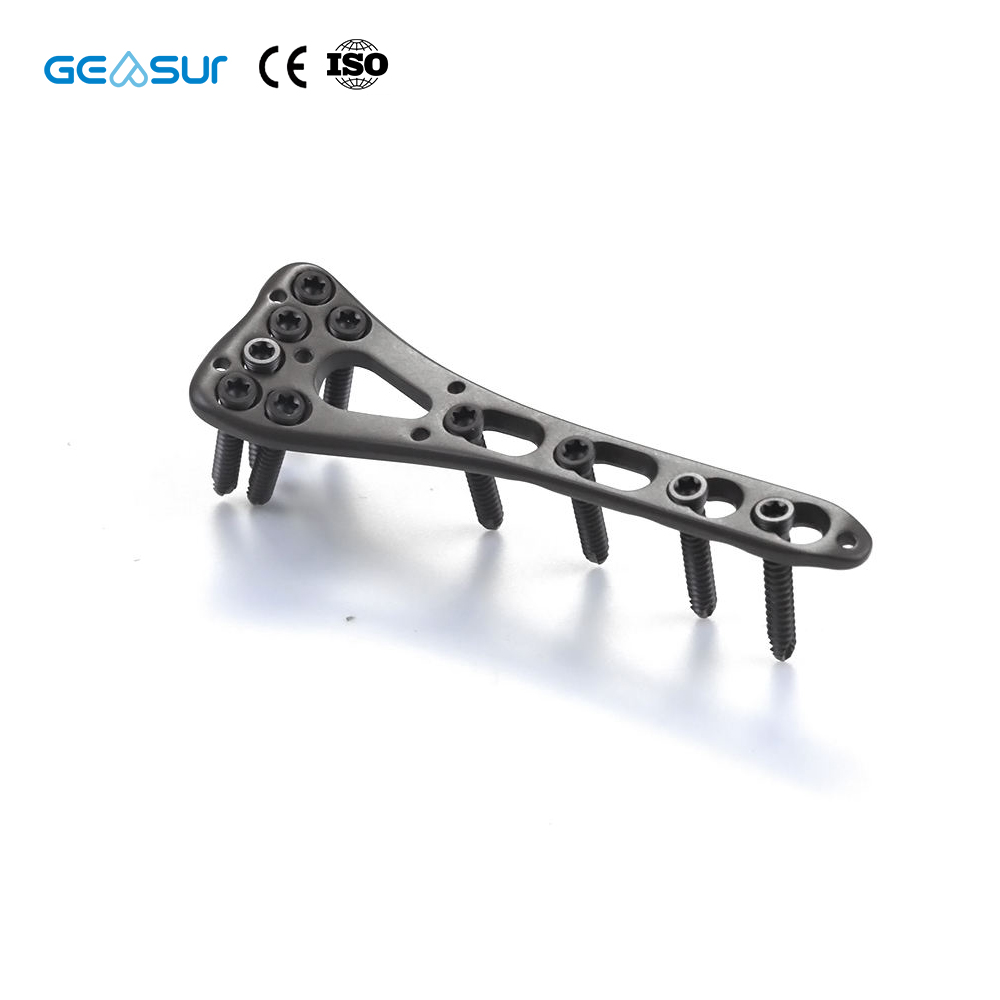 Geasure Distal Radius Locking Plate-Hospital Use Multiple Sizes Combi-Hole Design for Enhanced Fixation Flexibility 1 Year