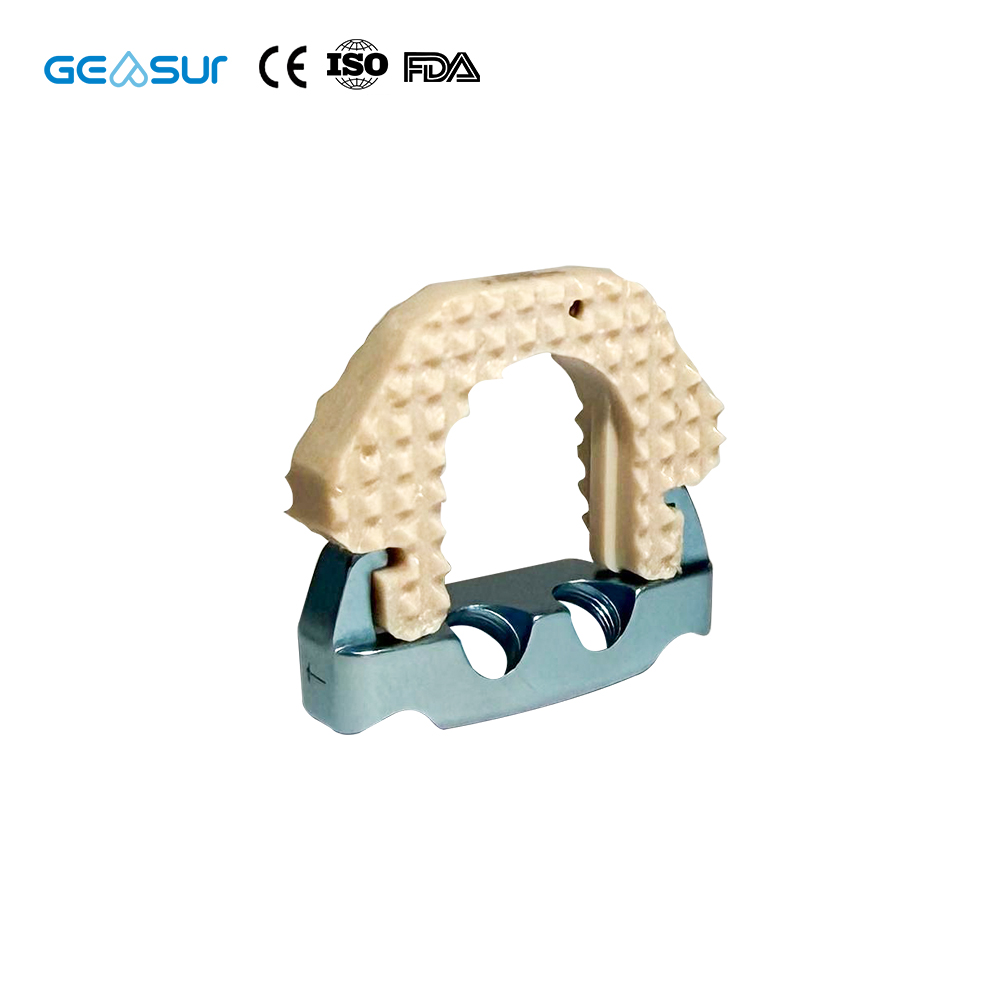 Geasure Cervical Peek Cage O Profile Titanium Pedicle Screws Favorable Hospital Price Implants & Interventional Materials