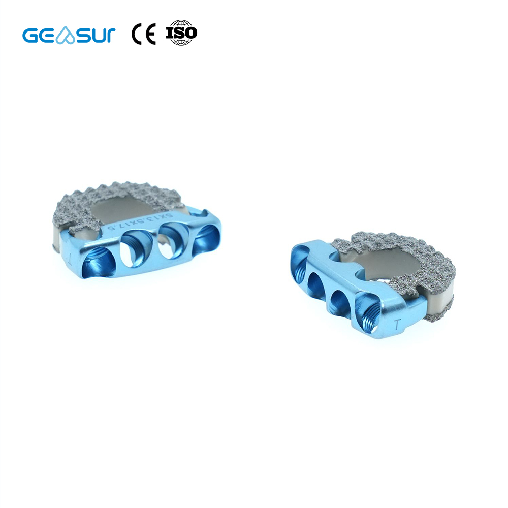 Geasure Zero-Profile Anterior Cervical Interbody Fusion PEEK Cage with Screw - Orthopedic Implant