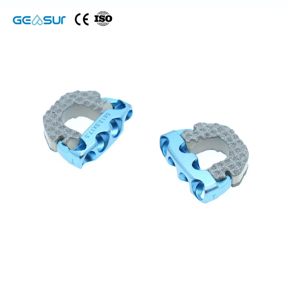 Geasure Zero-Profile Anterior Cervical Interbody Fusion PEEK Cage with Screw - Orthopedic Implant