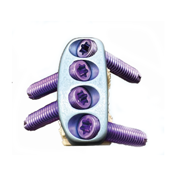 Cervical Spinal fusion Cage Cervical fusion Cage