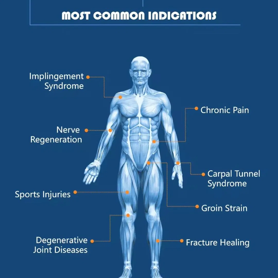 Magneto Therapy Pmst Pulsed Electromagnetic Field Therapy Devices Pain Relief and Management